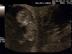 Baby2-10w4d-60508-2_72x54_c